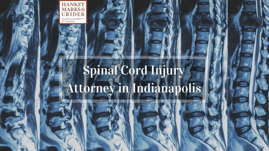 Fractured Bone Compensation Hazard thumbnail